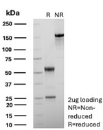 APC/Adenomatous Polyposis Coli/FAP (Tumor Suppressor) Antibody in SDS-PAGE (SDS-PAGE)
