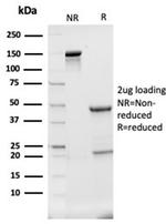 Haptoglobin (HP) Antibody in SDS-PAGE (SDS-PAGE)