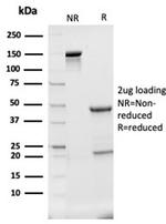 Haptoglobin (HP) Antibody in Immunoelectrophoresis (IE)
