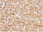 Haptoglobin (HP) Antibody in Immunohistochemistry (Paraffin) (IHC (P))