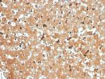 Haptoglobin (HP) Antibody in Immunohistochemistry (Paraffin) (IHC (P))