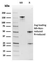 Haptoglobin (HP) Antibody in SDS-PAGE (SDS-PAGE)