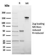 Haptoglobin (HP) Antibody in SDS-PAGE (SDS-PAGE)