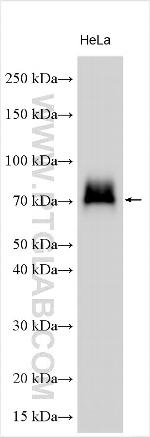 Fibrinogen gamma chain Antibody in Western Blot (WB)