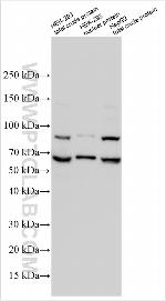 EDDM3B Antibody in Western Blot (WB)