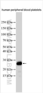 BRD1/BRL Antibody in Western Blot (WB)