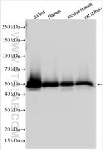 CD42c Antibody in Western Blot (WB)