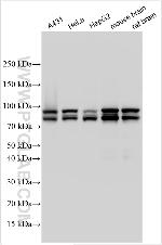 LCK Antibody in Western Blot (WB)
