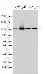 OPA1 Antibody in Western Blot (WB)