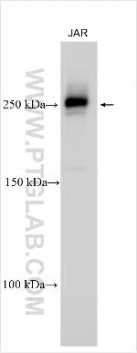 HSPA4L Antibody in Western Blot (WB)