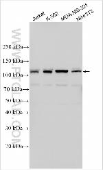 NUDCD1 Antibody in Western Blot (WB)