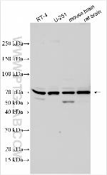 IPO8 Antibody in Western Blot (WB)