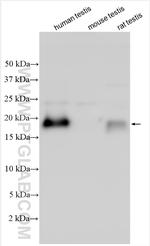 RNF220 Antibody in Western Blot (WB)