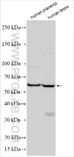 LELP1 Antibody in Western Blot (WB)