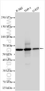 KCTD7 Antibody in Western Blot (WB)