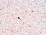 Serum Amyloid P/APCS Monoclonal Antibody (APCS, 3240)