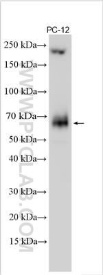 Ferritin light chain 1 Antibody in Western Blot (WB)
