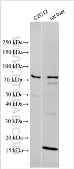 ZNF280B Antibody in Western Blot (WB)