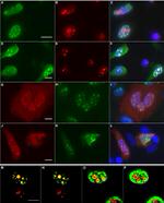 NPM1 Antibody in Immunocytochemistry (ICC/IF)