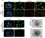 NPM1 Antibody in Immunocytochemistry (ICC/IF)