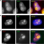 NPM1 Antibody in Immunocytochemistry (ICC/IF)