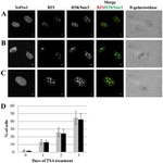 NPM1 Antibody in Immunocytochemistry (ICC/IF)