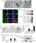 NPM1 Antibody in Western Blot, Immunocytochemistry (WB, ICC/IF)
