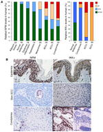 NPM1 Antibody in Immunohistochemistry (IHC)
