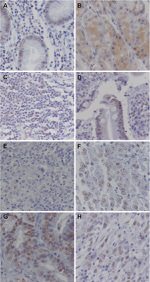 NPM1 Antibody in Immunohistochemistry (IHC)