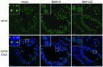 NPM1 Antibody in Immunohistochemistry (IHC)
