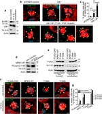 CEP170 Antibody in Immunocytochemistry (ICC/IF)
