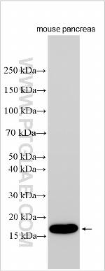 EPOR Antibody in Western Blot (WB)