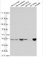 Reg2 Antibody in Western Blot (WB)