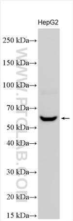 CD122/IL-2RB Antibody in Western Blot (WB)