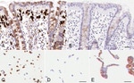 Claudin 2 Antibody in Immunohistochemistry (IHC)