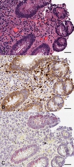 Claudin 2 Antibody in Immunohistochemistry (IHC)
