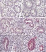 Claudin 2 Antibody in Immunohistochemistry (IHC)