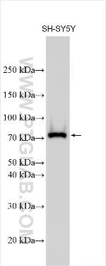 EPS8L3 Antibody in Western Blot (WB)