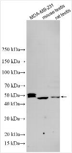 ZSCAN2 Antibody in Western Blot (WB)
