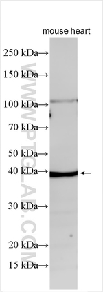 CIB2 Antibody in Western Blot (WB)