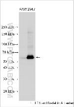 CTRB1 Antibody in Western Blot (WB)