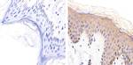 Desmoglein 1 Monoclonal Antibody (27B2)