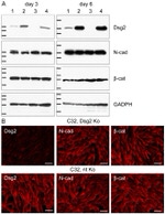 Desmoglein 2 Antibody in Western Blot (WB)