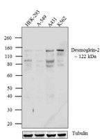Desmoglein 2 Monoclonal Antibody (6D8)