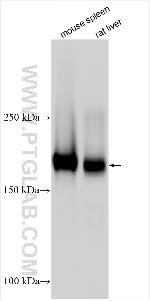 IL-1R2 Antibody in Western Blot (WB)
