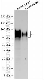 Uromodulin Antibody in Western Blot (WB)