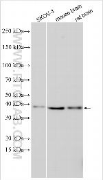 COPS7B Antibody in Western Blot (WB)