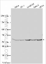 F8A2 Antibody in Western Blot (WB)