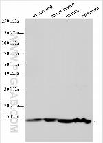 FAM171B Antibody in Western Blot (WB)