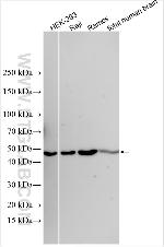 Beta-2-Microglobulin Antibody in Western Blot (WB)